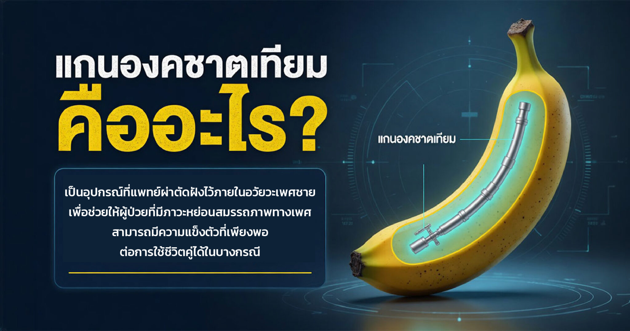 คำอธิบายรูปตามหัวข้อบทความ