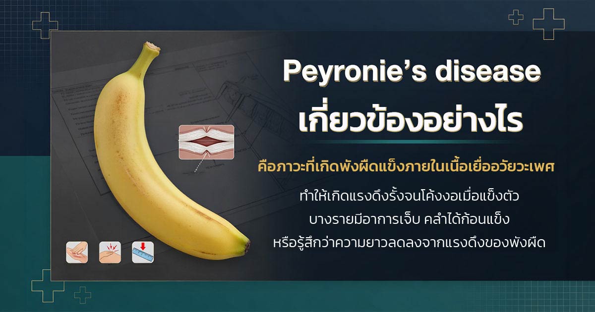 คำอธิบายรูปตามหัวข้อบทความ
