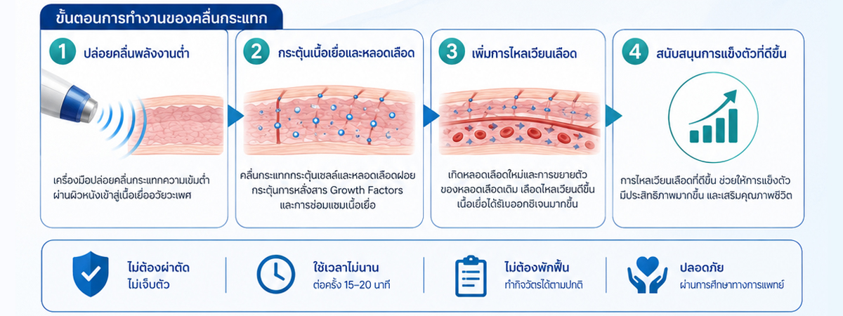 มุมมองของแพทย์ต่อการรักษา Shockwave ED