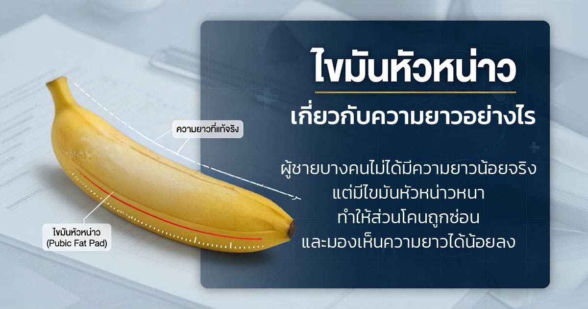 คำอธิบายรูปตามหัวข้อบทความ