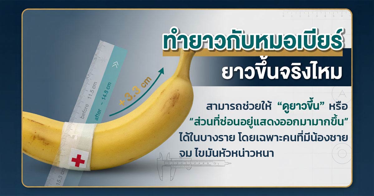 คำอธิบายรูปตามหัวข้อบทความ