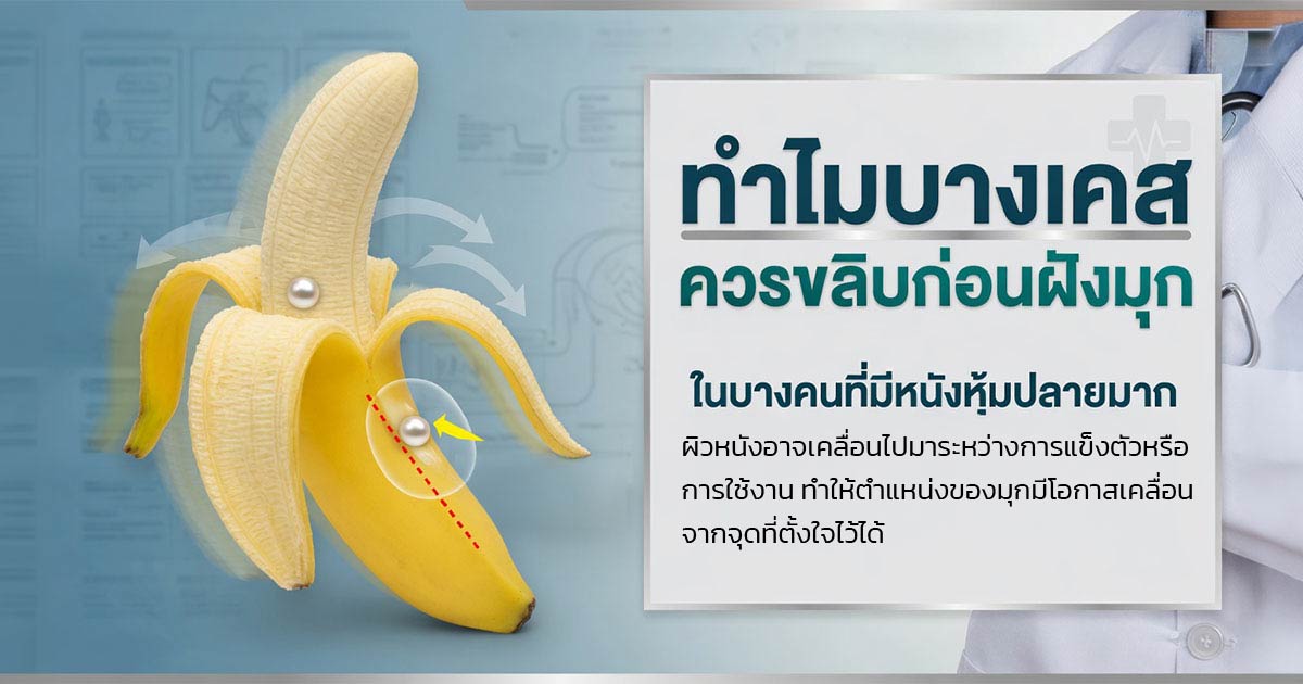 คำอธิบายรูปตามหัวข้อบทความ