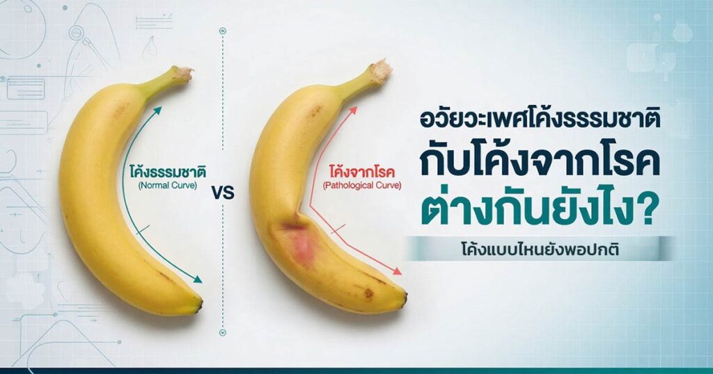 normal - ETERNITY CLINIC นพ.สืบพงษ์ เอ่งฉ้วน อวัยวะเพศโค้ง