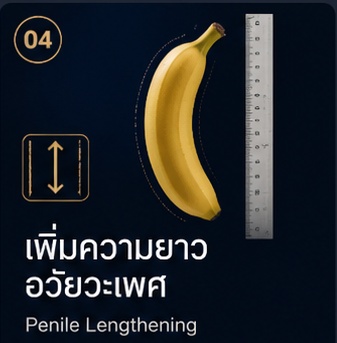 เพิ่มความยาวอวัยวะเพศ Penile Lengthening
