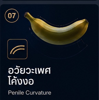 อวัยวะเพศโค้งงอ Penile Curvature