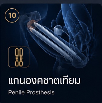 แกนองคชาตเทียม Penile Prosthesis