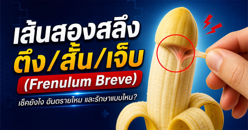Frenulum Breve - ETERNITY CLINIC นพ.สืบพงษ์ เอ่งฉ้วน เส้นสองสลึงตึง เช็คยังไง อันตรายไหม