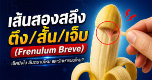 เส้นสองสลึงตึง เช็คยังไง อันตรายไหม