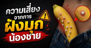 ความเสี่ยงจากการฝังมุก