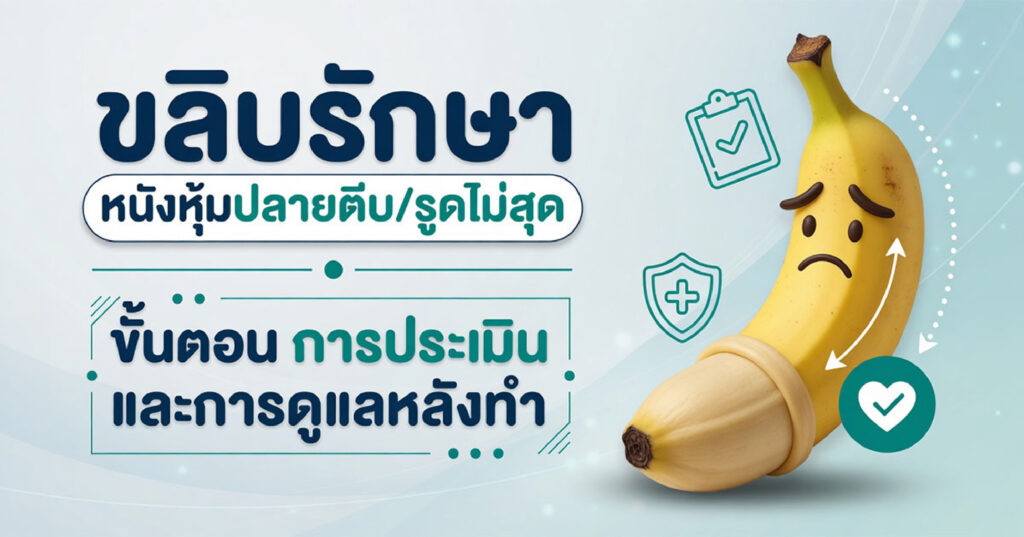 Phimosis - ETERNITY CLINIC นพ.สืบพงษ์ เอ่งฉ้วน ขลิบรักษาหนังหุ้มปลายตีบรูดไม่สุด