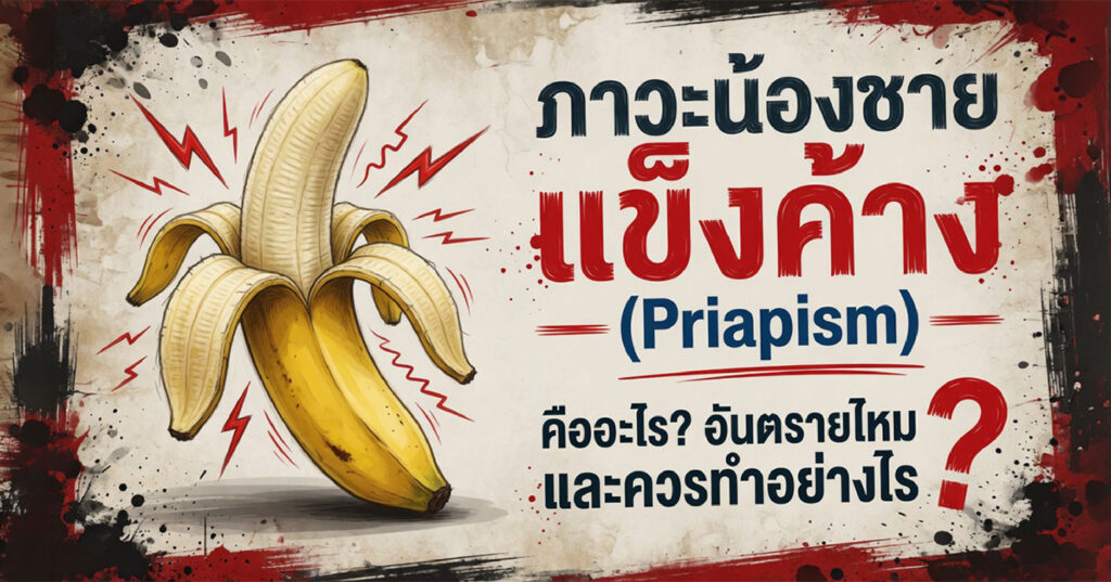Priapism - ETERNITY CLINIC นพ.สืบพงษ์ เอ่งฉ้วน ภาวะน้องชายแข็งค้าง