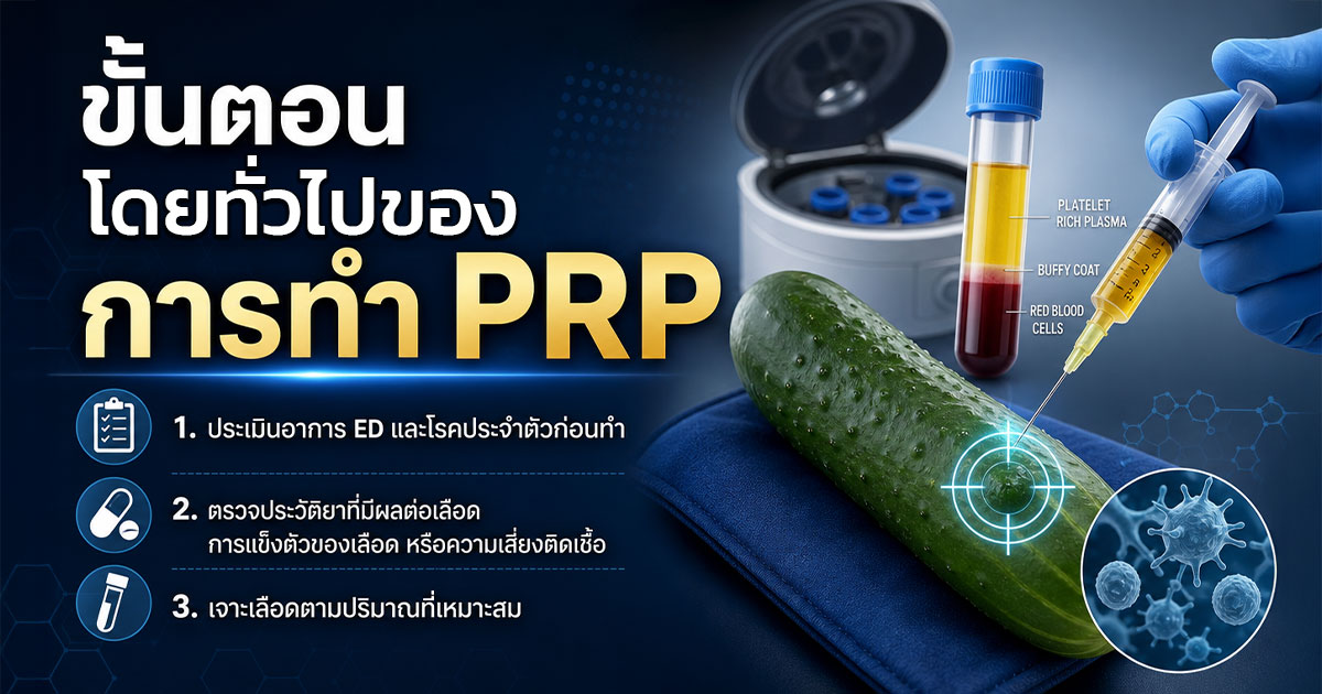 ขั้นตอนโดยทั่วไปของการทำ PRP
