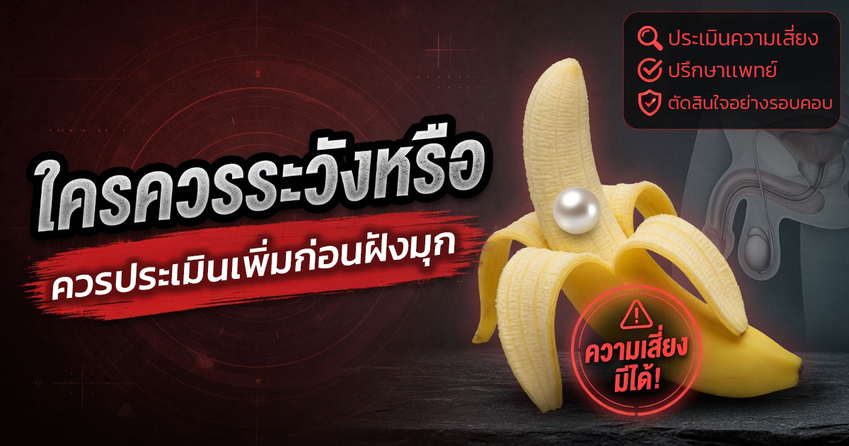 คำอธิบายรูปตามหัวข้อบทความ