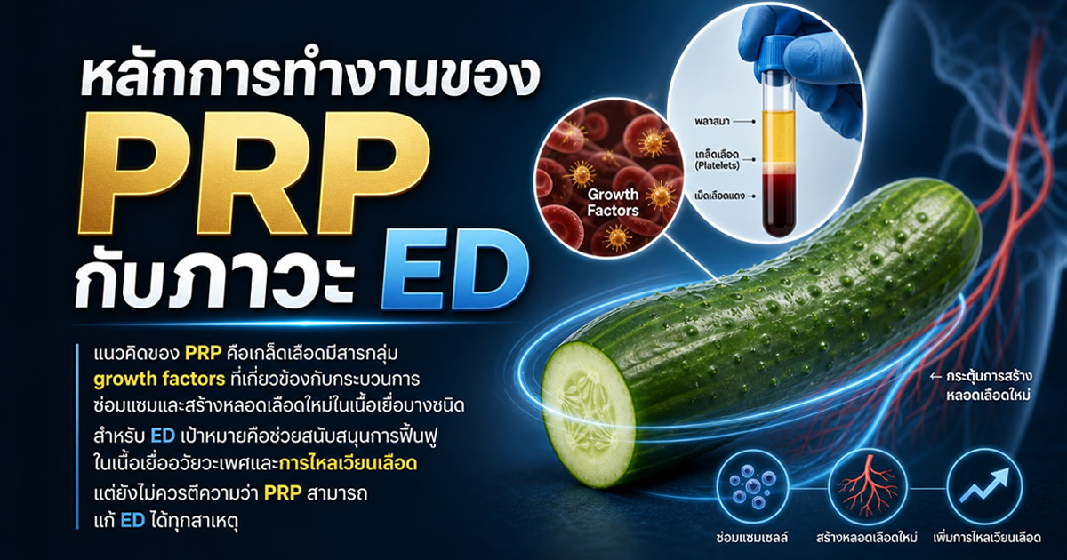 หลักการทำงานของ PRP กับภาวะ ED