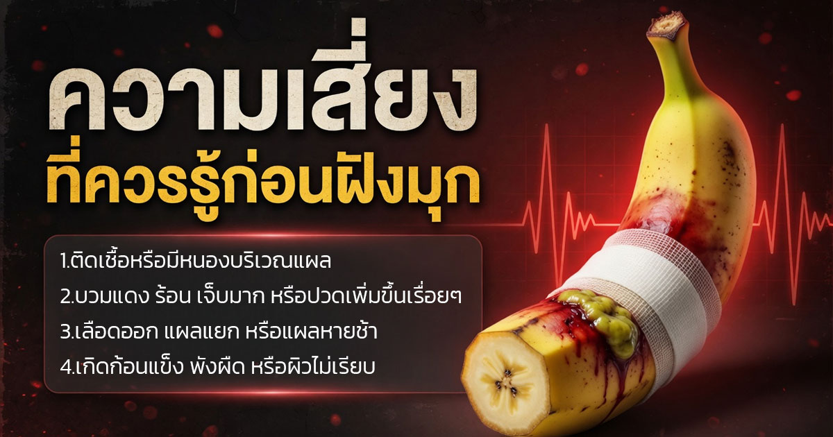 คำอธิบายรูปตามหัวข้อบทความ