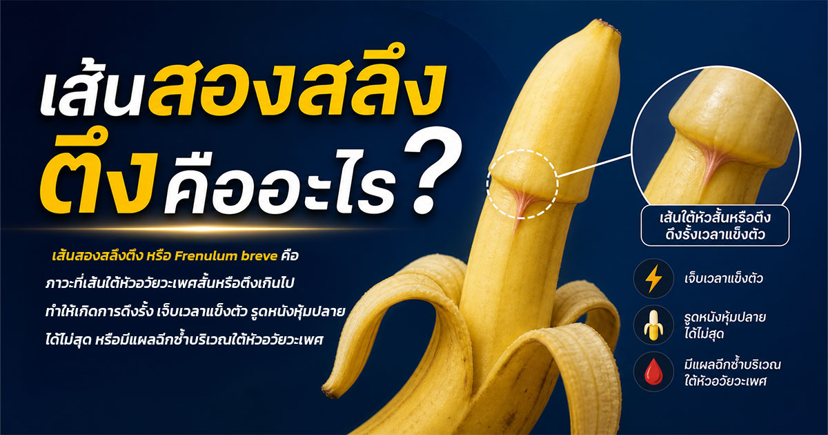 เส้นสองสลึงตึงคืออะไร