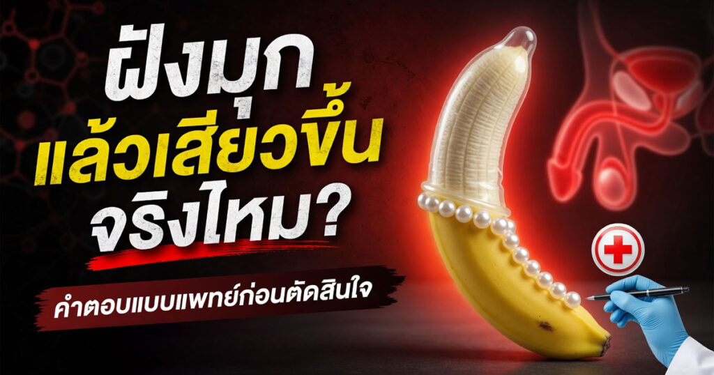 trf - ETERNITY CLINIC นพ.สืบพงษ์ เอ่งฉ้วน ฝังมุก