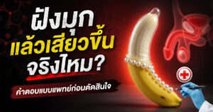 ฝังมุก