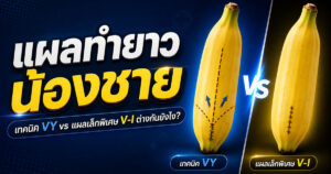 แผลทำยาวน้องชาย