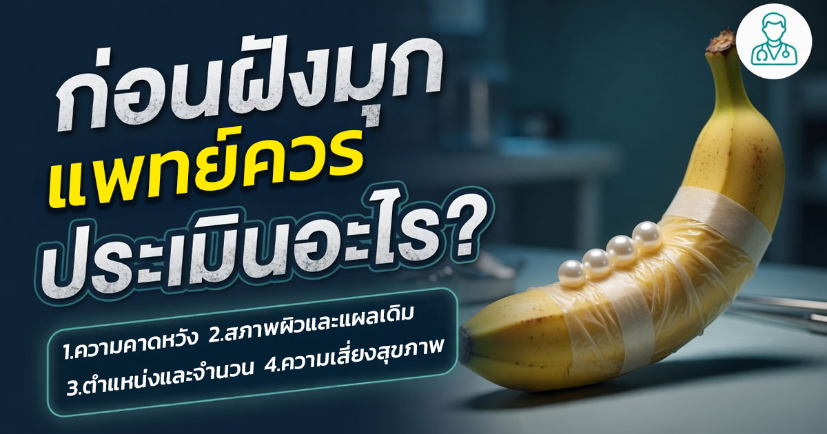 คำอธิบายรูปตามหัวข้อบทความ