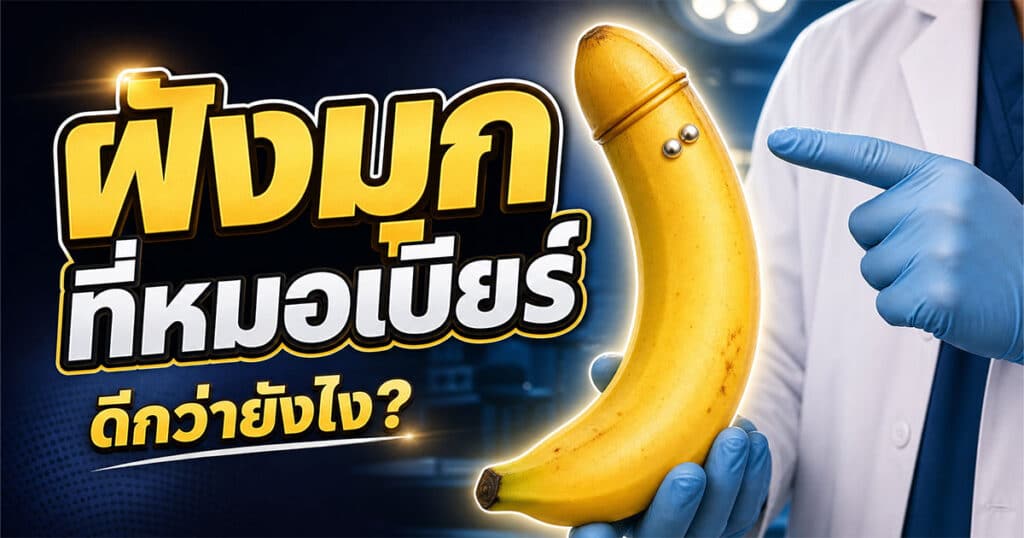 ฝังมุกที่หมอเบียร์ ดีกว่ายังไง