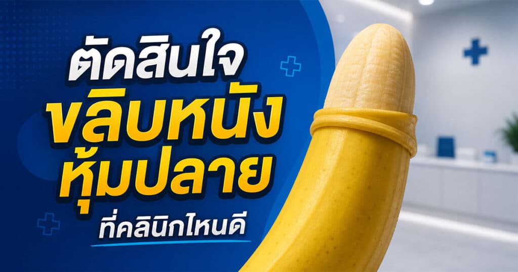 ขลิบหนังหุ้มปลายที่คลินิกไหนดี