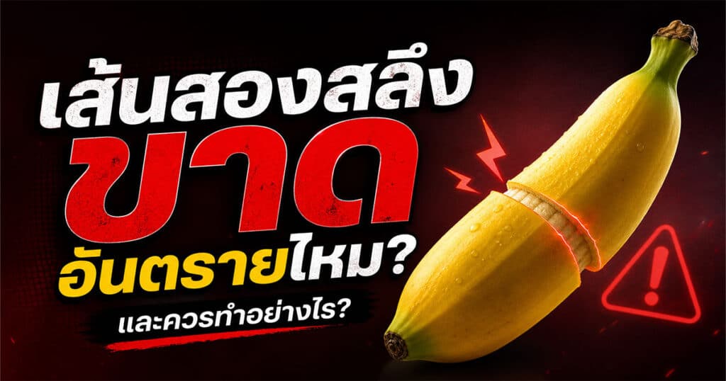 เส้นสองสลึงขาด อันตรายไหม และควรทำอย่างไร