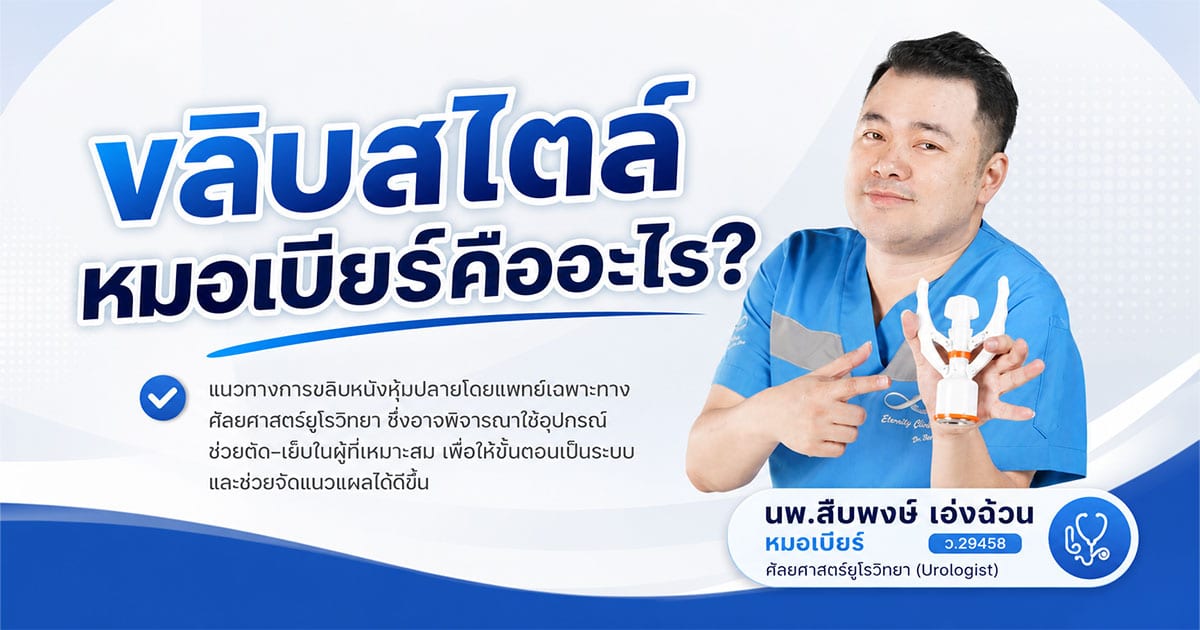 ขลิบสไตล์หมอเบียร์คืออะไร